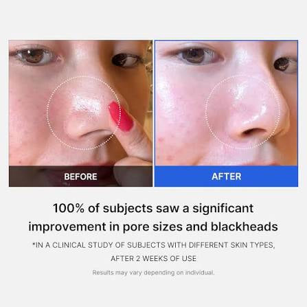 Medicube Zero Pore Pad - 70 patchs