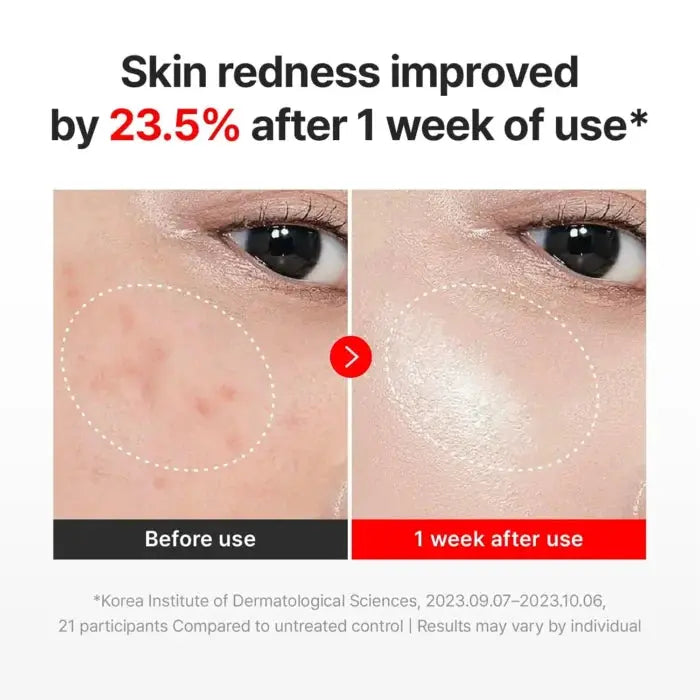 Centellian24 – Madeca Cream Time Reverse ZERO - 80ml - K-Beauty Studio